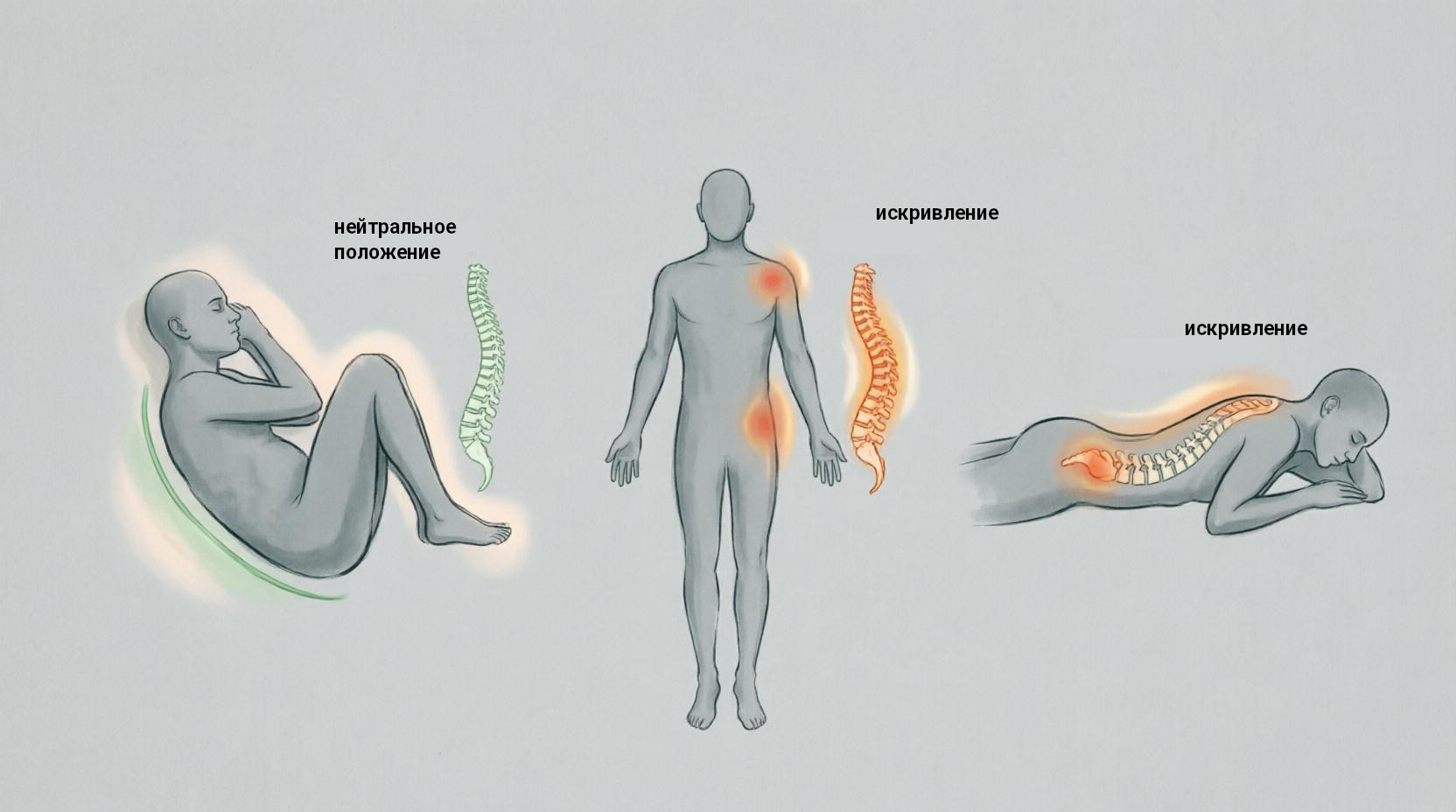 Инфографика позы сна: на боку, на спине, на животе с положением позвоночника